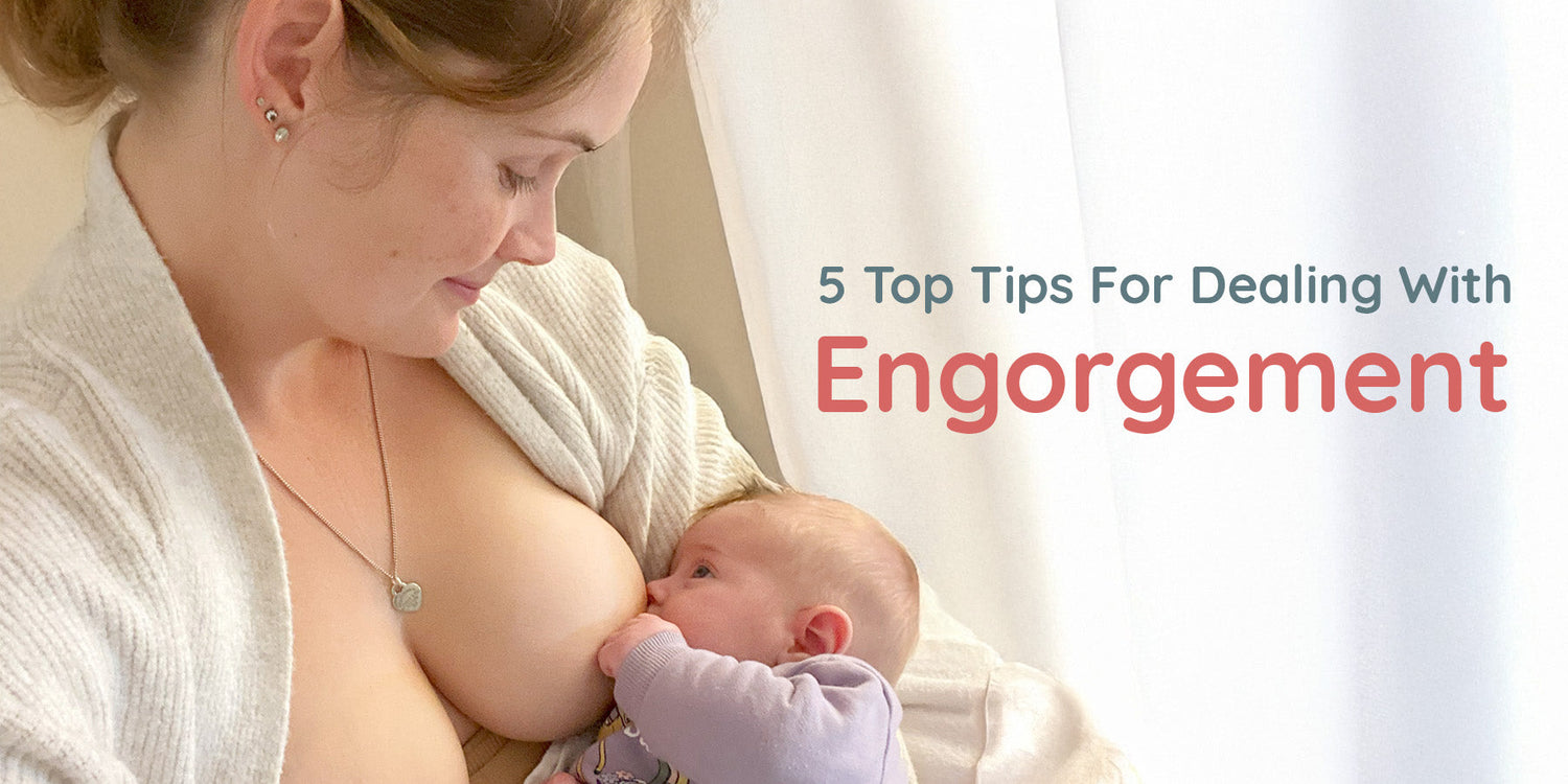 5 Top Tips For Dealing With Engorgement