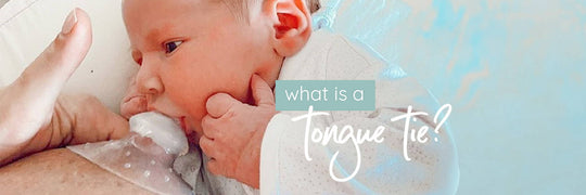 How do I know if my baby has a tongue tie?