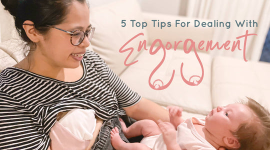 5 Top Tips For Dealing With Engorgement