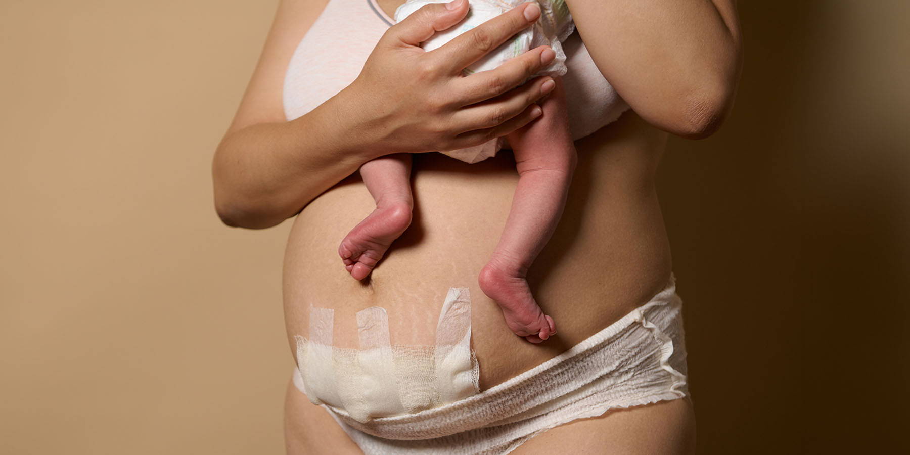 How to prepare for a C-section